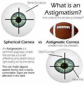 what is astigmatism graphic